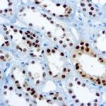 Immunohistochemical staining of Pax-8  of human FFPE tissue followed by incubation with HRP labeled secondary and development with DAB substrate.