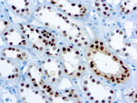 Immunohistochemical staining of Pax-8  of human FFPE tissue followed by incubation with HRP labeled secondary and development with DAB substrate.