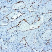 Immunohistochemical staining of PD1  of human FFPE tissue followed by incubation with HRP labeled secondary and development with DAB substrate.