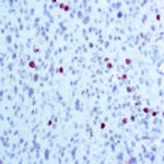 Immunohistochemical staining of Phosphohistone H3  of human FFPE tissue followed by incubation with HRP labeled secondary and development with DAB substrate.