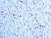 Immunohistochemical staining of Phosphohistone H3  of human FFPE tissue followed by incubation with HRP labeled secondary and development with DAB substrate.