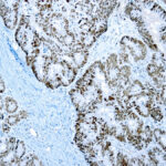 Immunohistochemical staining of PMS2  of human FFPE tissue followed by incubation with HRP labeled secondary and development with DAB substrate.