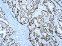 Immunohistochemical staining of PMS2  of human FFPE tissue followed by incubation with HRP labeled secondary and development with DAB substrate.