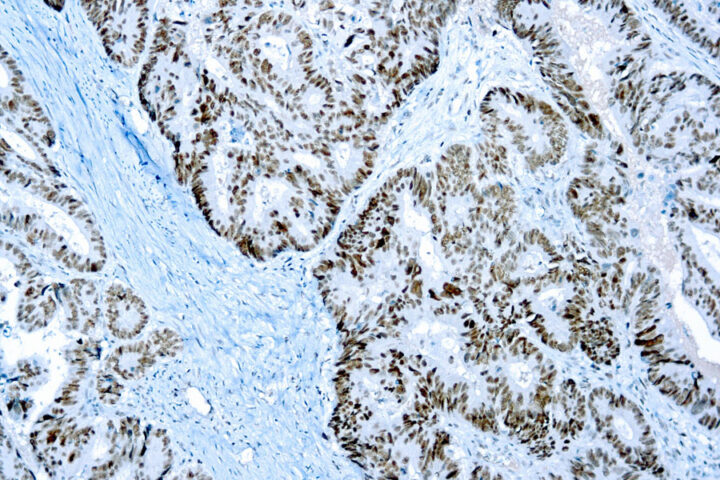 Immunohistochemical staining of PMS2  of human FFPE tissue followed by incubation with HRP labeled secondary and development with DAB substrate.