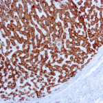 Immunohistochemical staining of Prohibitin  of human FFPE tissue followed by incubation with HRP labeled secondary and development with DAB substrate.