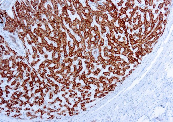 Immunohistochemical staining of Prohibitin  of human FFPE tissue followed by incubation with HRP labeled secondary and development with DAB substrate.