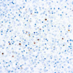 Immunohistochemical staining of Perforin  of human FFPE tissue followed by incubation with HRP labeled secondary and development with DAB substrate.