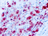 Immunohistochemical staining of S-100  of human FFPE tissue followed by incubation with HRP labeled secondary and development with DAB substrate.