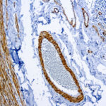 Immunohistochemical staining of Smooth Muscle Myosin  of human FFPE tissue followed by incubation with HRP labeled secondary and development with DAB substrate.