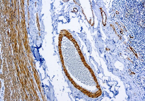Immunohistochemical staining of Smooth Muscle Myosin  of human FFPE tissue followed by incubation with HRP labeled secondary and development with DAB substrate.