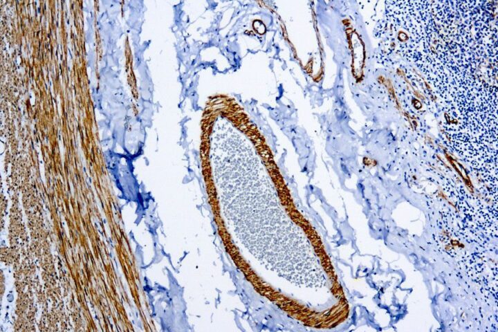 Immunohistochemical staining of Smooth Muscle Myosin  of human FFPE tissue followed by incubation with HRP labeled secondary and development with DAB substrate.