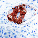 Immunohistochemical staining of Synaptophysin  of human FFPE tissue followed by incubation with HRP labeled secondary and development with DAB substrate.