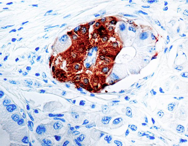 Immunohistochemical staining of Synaptophysin  of human FFPE tissue followed by incubation with HRP labeled secondary and development with DAB substrate.