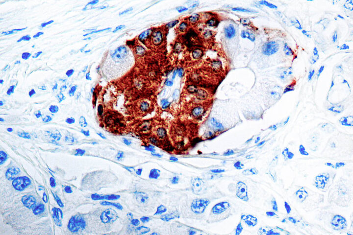 Immunohistochemical staining of Synaptophysin  of human FFPE tissue followed by incubation with HRP labeled secondary and development with DAB substrate.