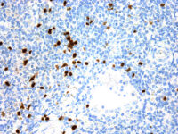 Immunohistochemical staining of Terminal Deoxynucleotidyl Transferase  of human FFPE tissue followed by incubation with HRP labeled secondary and development with DAB substrate.