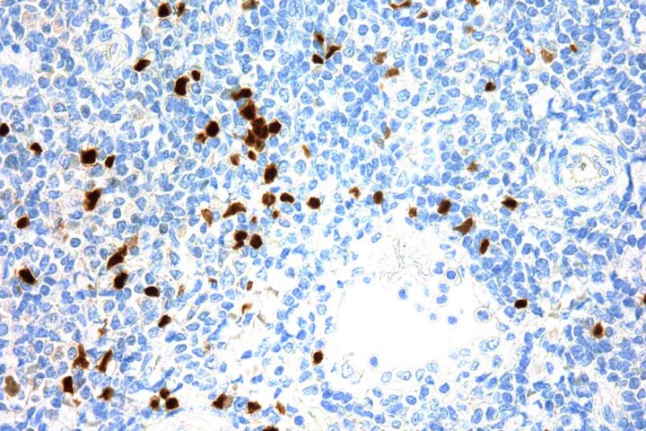 Immunohistochemical staining of Terminal Deoxynucleotidyl Transferase  of human FFPE tissue followed by incubation with HRP labeled secondary and development with DAB substrate.
