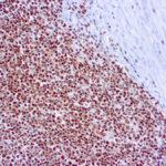 Immunohistochemical staining of RPA/p34  of human FFPE tissue followed by incubation with HRP labeled secondary and development with DAB substrate.