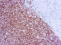 Immunohistochemical staining of RPA/p34  of human FFPE tissue followed by incubation with HRP labeled secondary and development with DAB substrate.