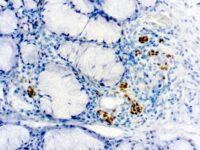 Immunohistochemical staining of TdT  of human FFPE tissue followed by incubation with HRP labeled secondary and development with DAB substrate.