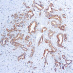 Immunohistochemical staining of Vascular Endothelial Growth Factor  of human FFPE tissue followed by incubation with HRP labeled secondary and development with DAB substrate.