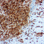 Immunohistochemical staining of Vimentin  of human FFPE tissue followed by incubation with HRP labeled secondary and development with DAB substrate.