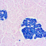 Immunohistochemical staining of Synaptophysin  of human FFPE tissue followed by incubation with HRP labeled secondary and development with DAB substrate.