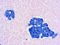 Immunohistochemical staining of Synaptophysin  of human FFPE tissue followed by incubation with HRP labeled secondary and development with DAB substrate.