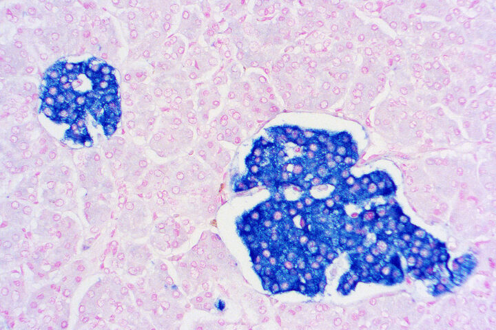 Immunohistochemical staining of Synaptophysin  of human FFPE tissue followed by incubation with HRP labeled secondary and development with DAB substrate.