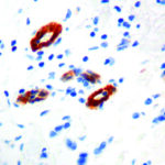 Immunohistochemical staining of Transglutaminase II  of human FFPE tissue followed by incubation with HRP labeled secondary and development with DAB substrate.