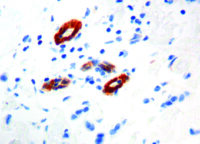 Immunohistochemical staining of Transglutaminase II  of human FFPE tissue followed by incubation with HRP labeled secondary and development with DAB substrate.