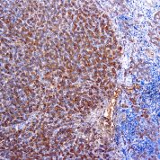 Immunohistochemical staining of alpha-1-Antitrypsin  of human FFPE tissue followed by incubation with HRP labeled secondary and development with DAB substrate.
