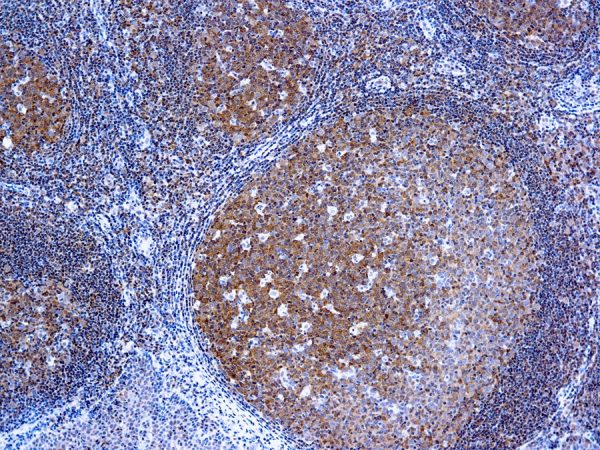 Immunohistochemical staining of Bcl-10  of human FFPE tissue followed by incubation with HRP labeled secondary and development with DAB substrate.