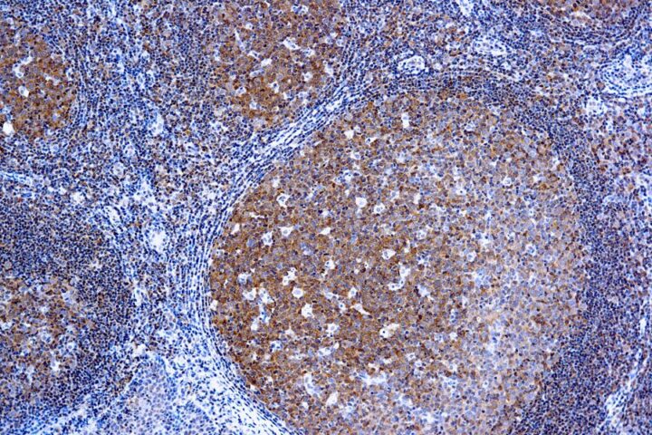 Immunohistochemical staining of Bcl-10  of human FFPE tissue followed by incubation with HRP labeled secondary and development with DAB substrate.