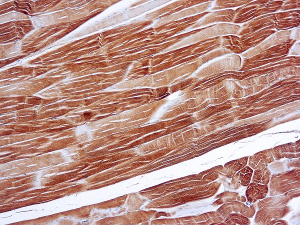 Immunohistochemical staining of Actin, Sarcomeric  of human FFPE tissue followed by incubation with HRP labeled secondary and development with DAB substrate.