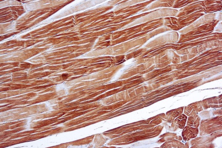 Immunohistochemical staining of Actin, Sarcomeric  of human FFPE tissue followed by incubation with HRP labeled secondary and development with DAB substrate.