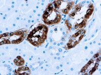 Immunohistochemical staining of Calbindin-D-28K  of human FFPE tissue followed by incubation with HRP labeled secondary and development with DAB substrate.