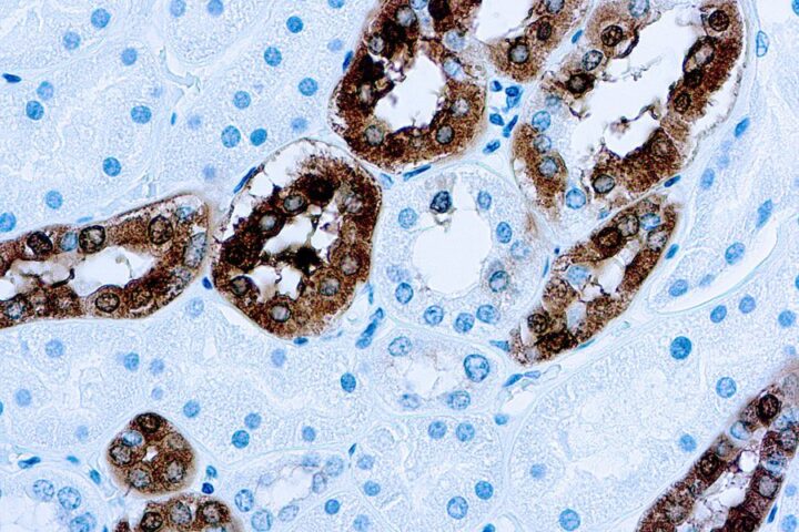 Immunohistochemical staining of Calbindin-D-28K  of human FFPE tissue followed by incubation with HRP labeled secondary and development with DAB substrate.