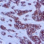 Immunohistochemical staining of CAM 5.2  of human FFPE tissue followed by incubation with HRP labeled secondary and development with DAB substrate.