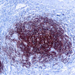 Immunohistochemical staining of CD21  of human FFPE tissue followed by incubation with HRP labeled secondary and development with DAB substrate.