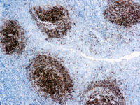 Immunohistochemical staining of CD23  of human FFPE tissue followed by incubation with HRP labeled secondary and development with DAB substrate.