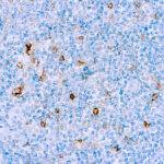 Immunohistochemical staining of CD25  of human FFPE tissue followed by incubation with HRP labeled secondary and development with DAB substrate.