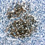 Immunohistochemical staining of CD21, B Cell  of human FFPE tissue followed by incubation with HRP labeled secondary and development with DAB substrate.