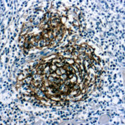 Immunohistochemical staining of CD21, B Cell  of human FFPE tissue followed by incubation with HRP labeled secondary and development with DAB substrate.