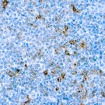 Immunohistochemical staining of CD25/IL-2R  of human FFPE tissue followed by incubation with HRP labeled secondary and development with DAB substrate.