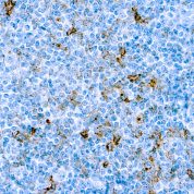 Immunohistochemical staining of CD25/IL-2R  of human FFPE tissue followed by incubation with HRP labeled secondary and development with DAB substrate.