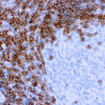 Immunohistochemical staining of CD3  of human FFPE tissue followed by incubation with HRP labeled secondary and development with DAB substrate.