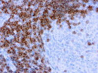 Immunohistochemical staining of CD3  of human FFPE tissue followed by incubation with HRP labeled secondary and development with DAB substrate.