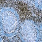 Immunohistochemical staining of CD3  of human FFPE tissue followed by incubation with HRP labeled secondary and development with DAB substrate.