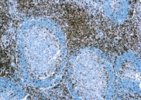 Immunohistochemical staining of CD3  of human FFPE tissue followed by incubation with HRP labeled secondary and development with DAB substrate.