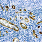 Immunohistochemical staining of CD34  of human FFPE tissue followed by incubation with HRP labeled secondary and development with DAB substrate.